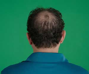 Hair Grow Max 2x1 a 20.021,60 HUF